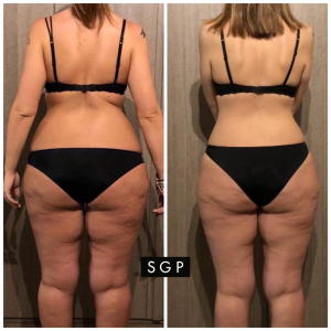 body transformation sgp