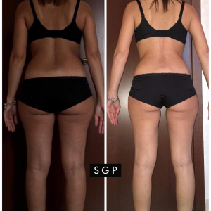 body transformation sgp2