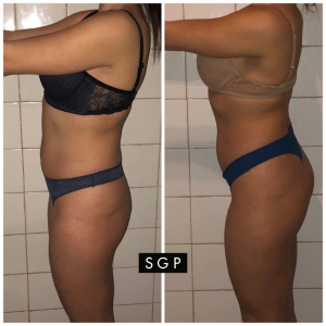 body transformation sgp