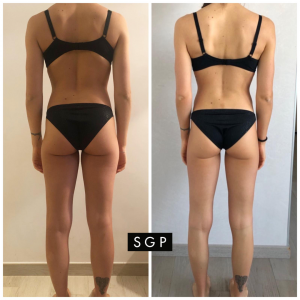 body transformatio SGP
